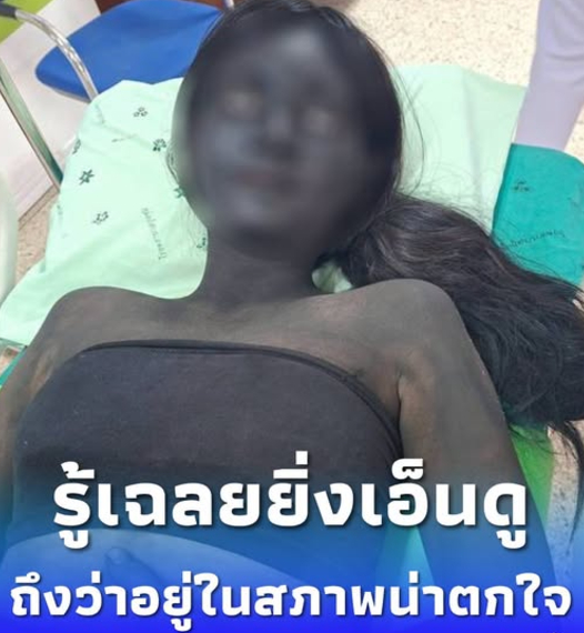 ทำเอาโซเชียลทั้งขำทั้งเอ็นดู เมื่อภาพของสาวนักเรียนวัย 16 ปี ถูกเจ้าหน้าที่กู้ภัยอุ้มขึ้นรถพยาบาล กลายเป็นไวรัลจนมีคนแชร์ต่อจำนวนมาก หลายคนถึงกับแซวว่าเป็นภารกิจที่กู้ภัยไม่มีวันลืม เพราะเห็นครั้งแรกถึงกับหัวใจแทบวาย ก่อนรู้ความจริงว่าทั้งหมดเป็นเพียงชุดการแสดงในกิจกรรมวันภาษาไทยของโรงเรียน แต่ดันเกิดอาการปวดท้องกะทันหัน จนต้องรีบนำตัวส่งโรงพยาบาล กู้ภัยแทบวิ่ง รับคนไข้ฉุกเฉิน รู้เฉลยยิ่งเอ็นดูทำไมอยู่สภาพนี้ เรื่องราวดังกล่าวถูกเผยแพร่โดยผู้ใช้เฟซบุ๊ก ณัฐ ณัฐวัฒน์ อาสาฯ กู้ภัยฮุก 31 กุดชุม เมื่อวันที่ 24 กรกฎาคม 2569 พร้อมข้อความว่า “น้องทำถึง เห็นคนป่วยครั้งแรกกู้ชีพก็แอบตกใจ ออกรับผีกะส่งโรงพยาบาล” กู้ภัยแทบวิ่ง รับคนไข้ฉุกเฉิน รู้เฉลยยิ่งเอ็นดูทำไมอยู่สภาพนี้ โดยหน่วยกู้ภัยได้รับแจ้งให้เข้าช่วยเหลือผู้ป่วยหญิง อายุ 16 ปี ภายในโรงเรียนแห่งหนึ่งในพื้นที่ ต.กุดชุม อ.กุดชุม จ.ยโสธร หลังมีอาการปวดท้อง แต่ยังรู้สึกตัวดี เจ้าหน้าที่จึงปฐมพยาบาลเบื้องต้น ก่อนเคลื่อนย้ายส่งโรงพยาบาลเพื่อให้แพทย์ตรวจรักษา สำหรับสาเหตุที่ผู้ป่วยแต่งกายเป็น “ผีกะ” นั้น เนื่องจากกำลังร่วมแสดงละครในกิจกรรมวันภาษาไทยของโรงเรียน ส่งผลให้เมื่อเดินทางถึงโรงพยาบาล ก็สร้างความฮือฮาให้กับทั้งเจ้าหน้าที่และผู้ที่พบเห็นไม่น้อย กู้ภัยแทบวิ่ง รับคนไข้ฉุกเฉิน รู้เฉลยยิ่งเอ็นดูทำไมอยู่สภาพนี้ ต่อมา น้องผู้ป่วยได้เข้ามาคอมเมนต์ใต้โพสต์ด้วยข้อความว่า “หนูไม่คิดเลยค่ะว่าจะปวดท้องถูกเวลาแต่ผิดที่” ทำเอาชาวเน็ตต่างเข้ามาแสดงความคิดเห็นด้วยความเอ็นดู หลายคนบอกว่าโชคดีที่เกิดเหตุในช่วงกลางวัน เพราะหากเป็นเวลากลางคืนอาจทำเอาหลายคนตกใจไม่น้อย กู้ภัยแทบวิ่ง รับคนไข้ฉุกเฉิน รู้เฉลยยิ่งเอ็นดูทำไมอยู่สภาพนี้ ภายหลัง หน่วยกู้ภัยยังเผยคลิปอัปเดตอาการของน้อง โดยระบุว่า “หนูปลอดภัยดี รับยากลับบ้านแล้วนะ” พร้อมเผยภาพน้องยืนยิ้มถือถุงยาอยู่ภายในโรงพยาบาล สร้างความโล่งใจให้กับผู้ติดตามเรื่องราวจำนวนมาก กู้ภัยแทบวิ่ง รับคนไข้ฉุกเฉิน รู้เฉลยยิ่งเอ็นดูทำไมอยู่สภาพนี้